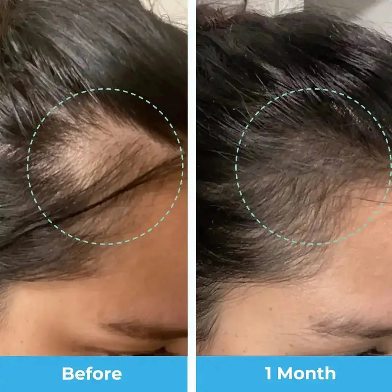 Baby Blues Postpartum Hair Loss Vitamins Gummy Vitamins