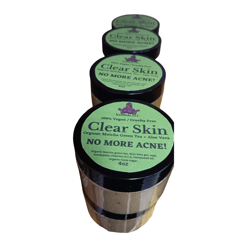 KaziRokz Organic Matcha Green Tea + Aloe Vera Acne Treatment/ Clear Skin Treatment (100% Vegan/CrueltyFree) 4oz