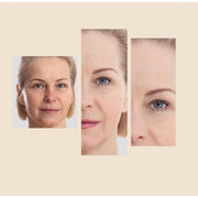 gymsegbë The Eraser Spot Cream | Dark Spot Corrector Dark Spots, Hyperpigmentation