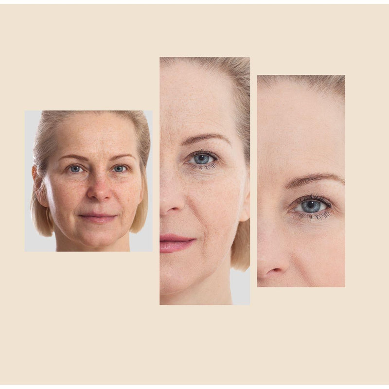 gymsegbë The Eraser Spot Cream | Dark Spot Corrector Dark Spots, Hyperpigmentation