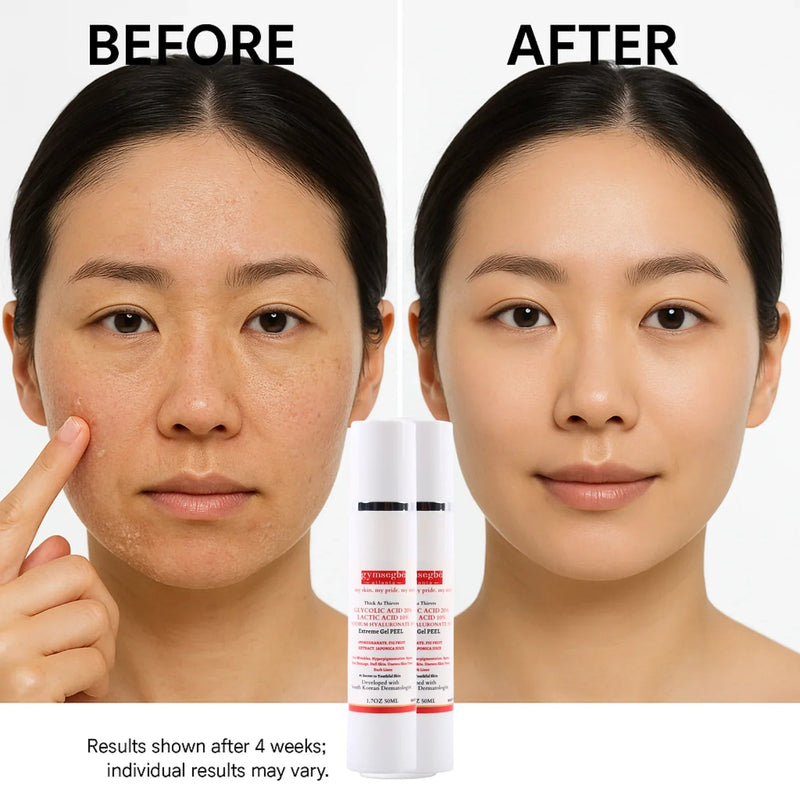 gymsegbë Thick As Thieves Pure Glycolic Acid Lactic Acid Extreme Gel Peel - 50ml Exfoliation, Dark Spots, Hyperpigmentation White Smoke 1 BottleSave 6.90,2 Bottles Save $9.99,3 bottles Save $12.98,4 Bottles Save $24.97
