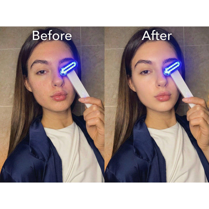ZAQ Skin & Body ZAQ Zayn 2.0 — 6-in-1 LED & Microcurrent Facial Wand