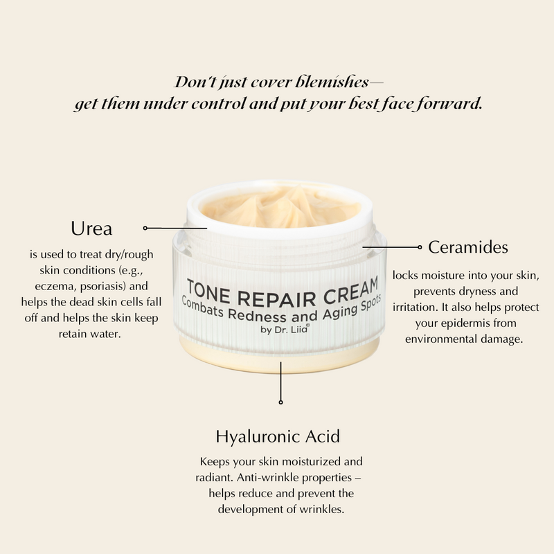 EpiLynx Brightening Tone Repair Cream for Dark Spots & Uneven Skin – Vegan & Gluten-Free Face Creams