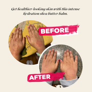 EpiLynx Velvet Hydration Body Balm – Ultra-Rich, Vegan, Gluten-Free Moisture for Dry & Sensitive Skin moisturizer