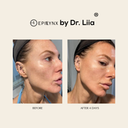 EpiLynx Pore Refining & Redness Relief Serum – Vegan, Gluten-Free, Hypoallergenic Brightening Formula Face Serums