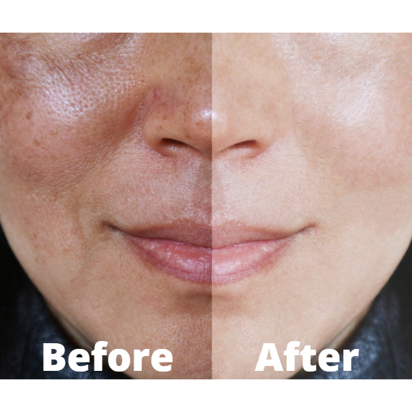 Bio Jouvance Paris Consumer Bio Plasma Pen Wholesale