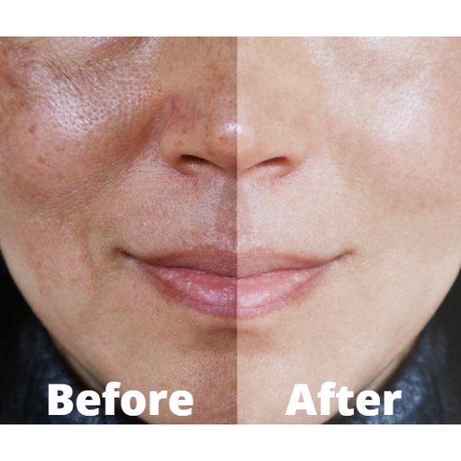 Bio Jouvance Paris Consumer Bio Plasma Pen Wholesale