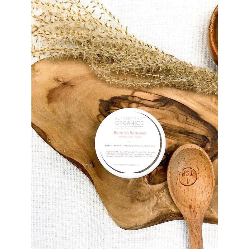 Butter Me Up Organics Organic Blemish Cream/ Dark Spot Remover / Scar Cream / Acne Spot Treatment Face