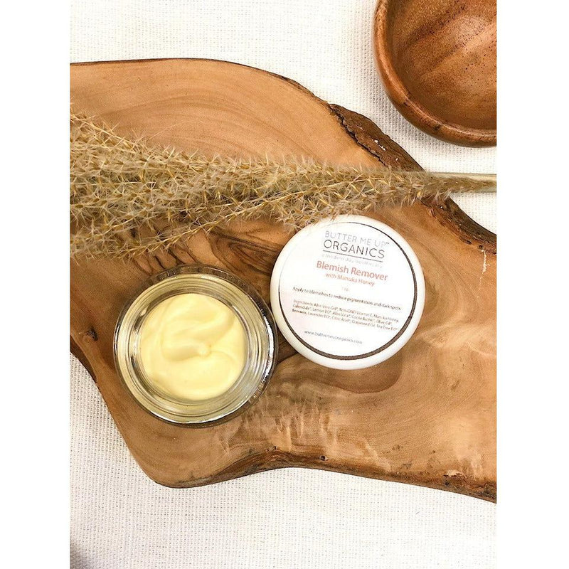 Butter Me Up Organics Organic Blemish Cream/ Dark Spot Remover / Scar Cream / Acne Spot Treatment Face