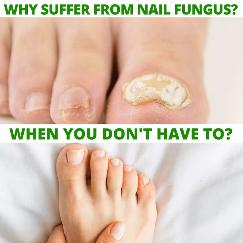 COLEHERBALS 12 - Dr. Cole's Nail Fungus Balm Herbal