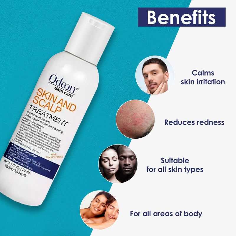 Mill's Beauty Supply Odeon Skin & Scalp Treatment, 3.5 Oz Skin Care Products