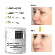 EpiLynx Wrinkle Repair Retinol Night Cream – Vegan, Gluten-Free, Regenerating Anti-Aging Moisturizer Face Creams