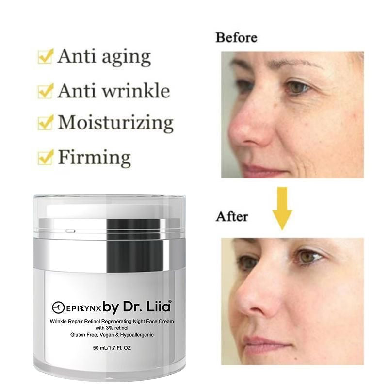 EpiLynx Wrinkle Repair Retinol Night Cream – Vegan, Gluten-Free, Regenerating Anti-Aging Moisturizer Face Creams