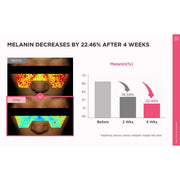 AsiaBeautyMall ANUA Peach 70 Niacin Serum Serum