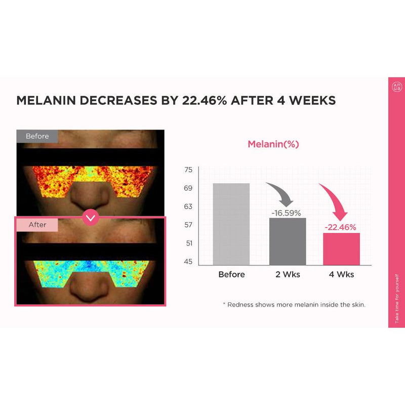 AsiaBeautyMall ANUA Peach 70 Niacin Serum Serum