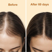 yoni rescue Hair Growth Oil Hair Oil