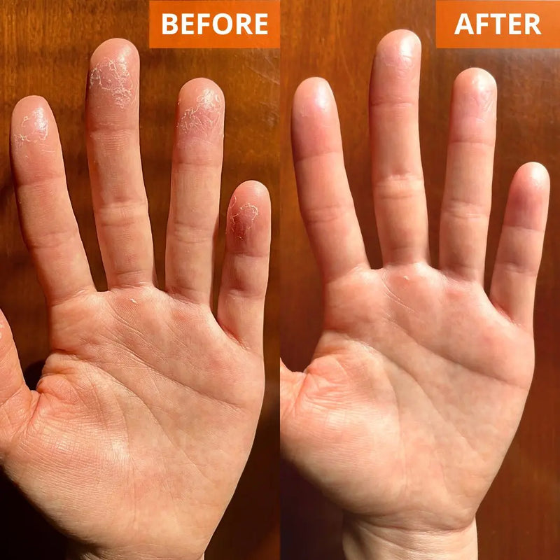 Yu-Be Moisturizing Skin Cream 4.4 Fl. Oz. Jar (Shopify Collective) Skin Moisturizer