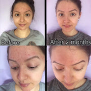 Timeless Organics Skin Care 3-Step Acne System Kit