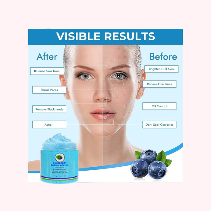 Www.Alesmaxii.Com Khichi Beauty Blueberry Facial Polish, With Real Blueberry Juice, 150 / 5.1 Fl Oz