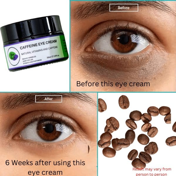 Www.Alesmaxii.Com Khichi Beauty Caffeine Eye Cream