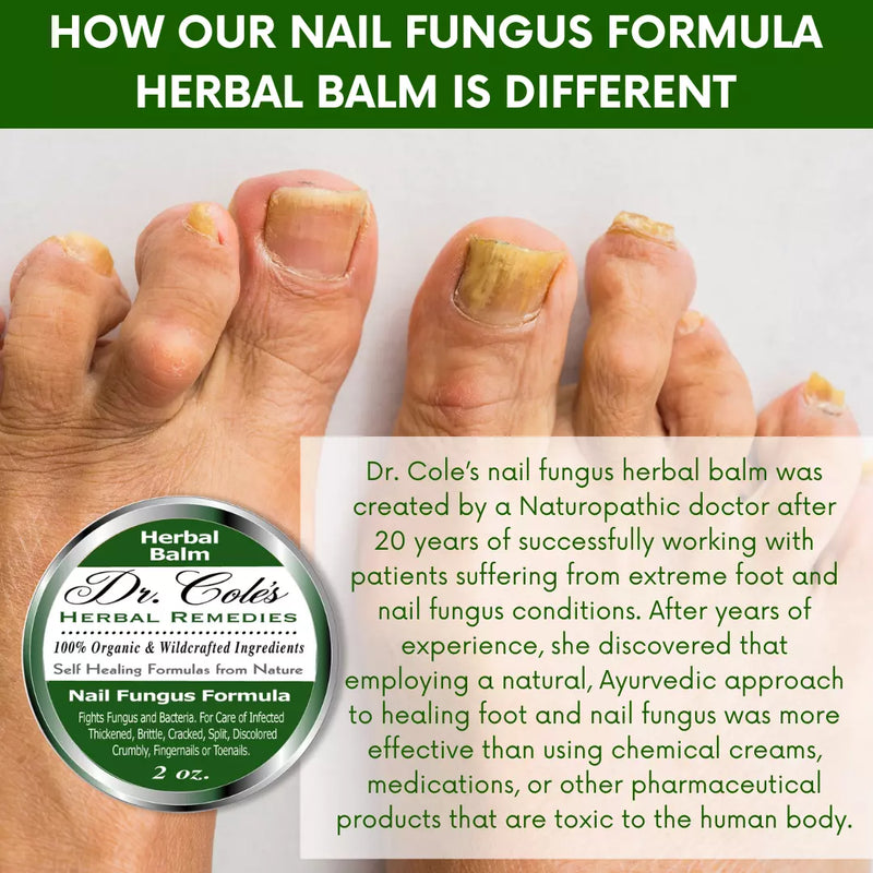 COLEHERBALS 12 - Dr. Cole's Nail Fungus Balm Herbal
