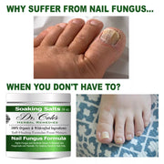 COLEHERBALS 13 - Dr. Cole's Organic Nail Fungus Salts Formula Herbal