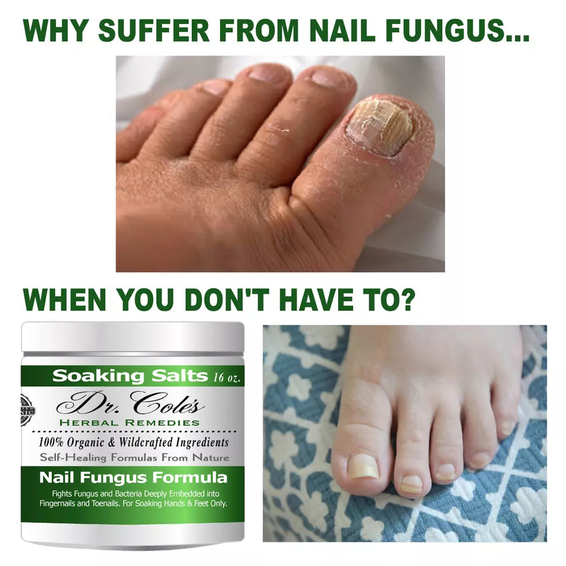 COLEHERBALS 13 - Dr. Cole's Organic Nail Fungus Salts Formula Herbal