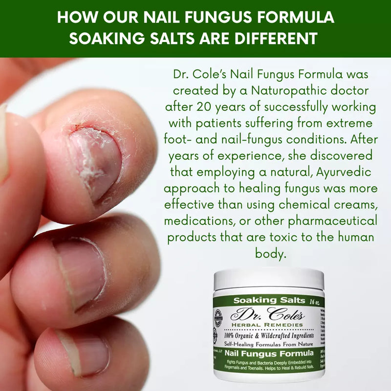 COLEHERBALS 13 - Dr. Cole's Organic Nail Fungus Salts Formula Herbal
