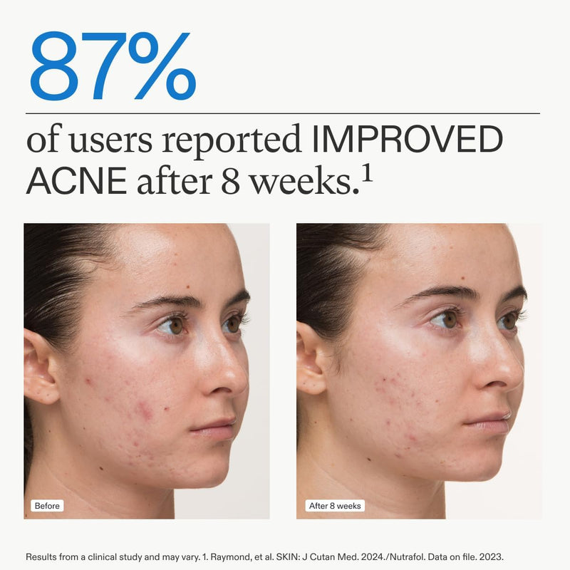 Nava Beauty Nutrafol Clear Skin Nutraceutical Acne Supplement 3-Month Supply White Smoke