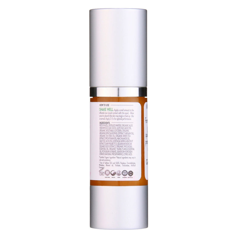Glimmer Goddess® Organic Skin Care Organic Acne Serum – Oil Control & Pore Clearing Treatment Serums