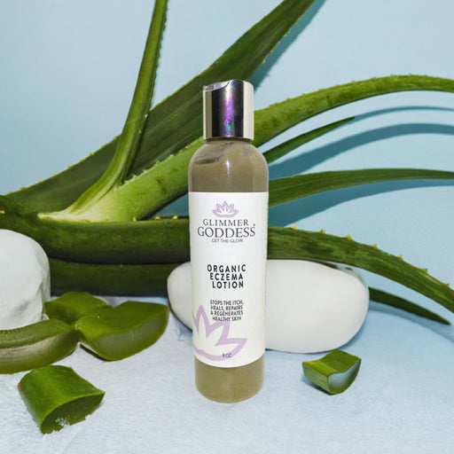 Glimmer Goddess® Organic Skin Care Organic Eczema Lotion – Soothing Relief & Skin Healing Lotions & Creams