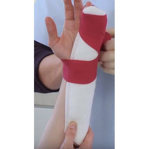 OrthoTape.com Boxer Fracture Ulnar Gutter Fiberglass Splint Kit Treatment - OrthoTape