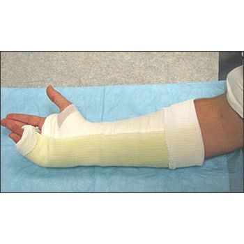 OrthoTape.com Boxer Fracture Ulnar Gutter Fiberglass Splint Kit Treatment - OrthoTape