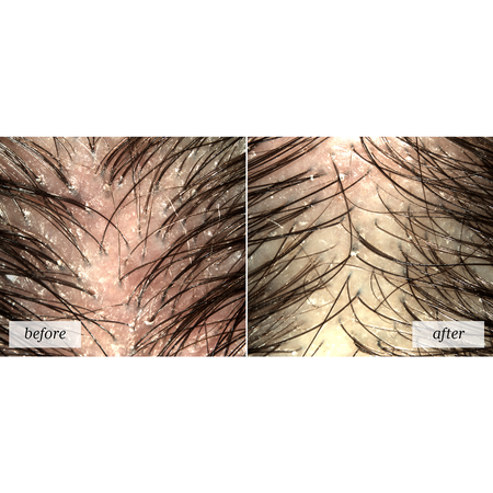 Rene Furterer Rene Furterer Astera Fresh Soothing Freshness Concentrate (Pre-Shampoo) 50ml/1.6o Pre-Shampoo