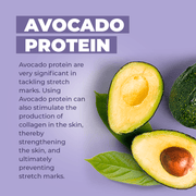 Baby Jolie Paris Stretch Marks Cream | Triple Action for Pregnancy Mom Care > Stretch Mark Cream > Stretch Mark Cream for Pregnancy