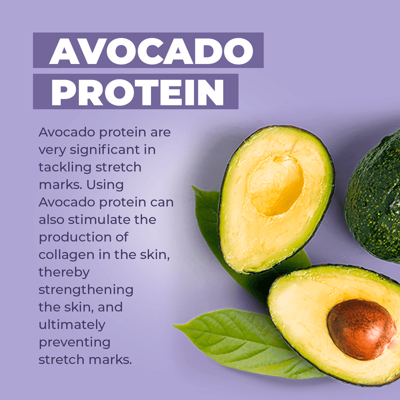 Baby Jolie Paris Stretch Marks Cream | Triple Action for Pregnancy Mom Care > Stretch Mark Cream > Stretch Mark Cream for Pregnancy