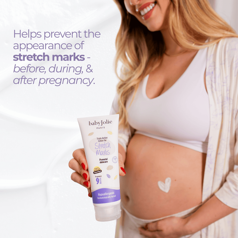 Baby Jolie Paris Triple Action Stretch Marks Cream Mom Care > Stretch Mark Cream > Stretch Mark Cream for Pregnancy White Smoke