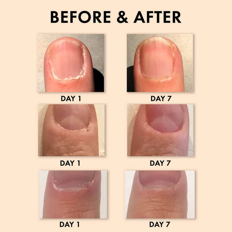 whish beauty Coconut Milk + Verbena Cuticle Oil - 40% OFF Body Care > Hand and Foot Treatment