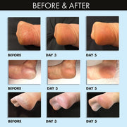 whish beauty Coconut Milk + Verbena Exfoliating Foot Mask Body Care > Exfoliators > Foot Mask