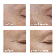 whish beauty Revitalizing Eye Cream with Bakuchiol - New and Improved! Skin Care > Eye Treatment